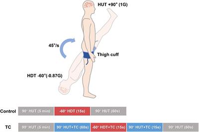 Cuff-Method Thigh Arterial Occlusion Counteracts Cerebral Hypoperfusion Against the Push–Pull Effect in Humans